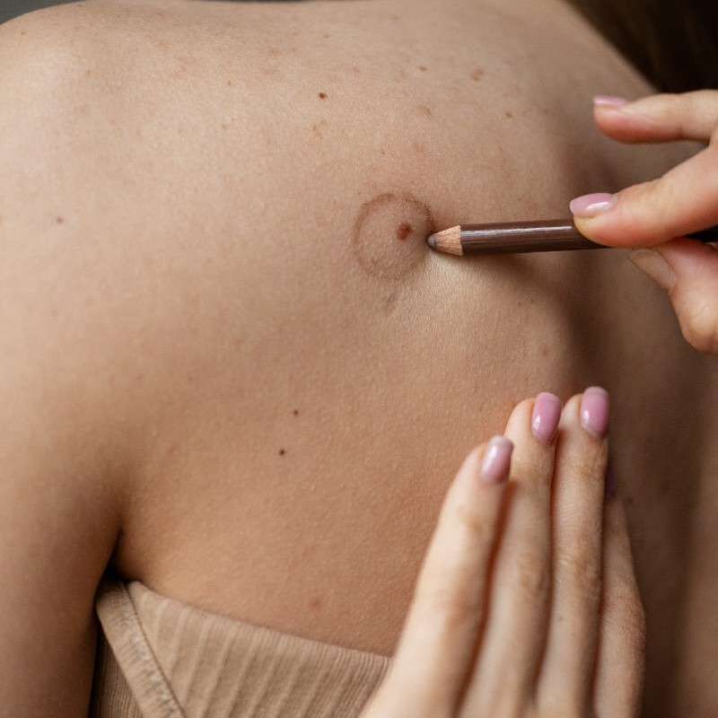 Moles